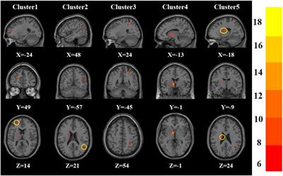 A comparative study of amplitude of low-frequence fluctuation of resting-state fMRI between the younger and older treatment-resistant depression in adults